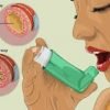 Treatment for Asthma and Ayurvedic Doctor & Hospital in Hyderabad and Vizag India