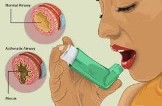 You are currently viewing Treatment for Asthma and Ayurvedic Doctor & Hospital in Hyderabad and Vizag India