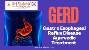 Read more about the article GERD-Gastro Esophageal Reflux Disease Ayurvedic Treatment